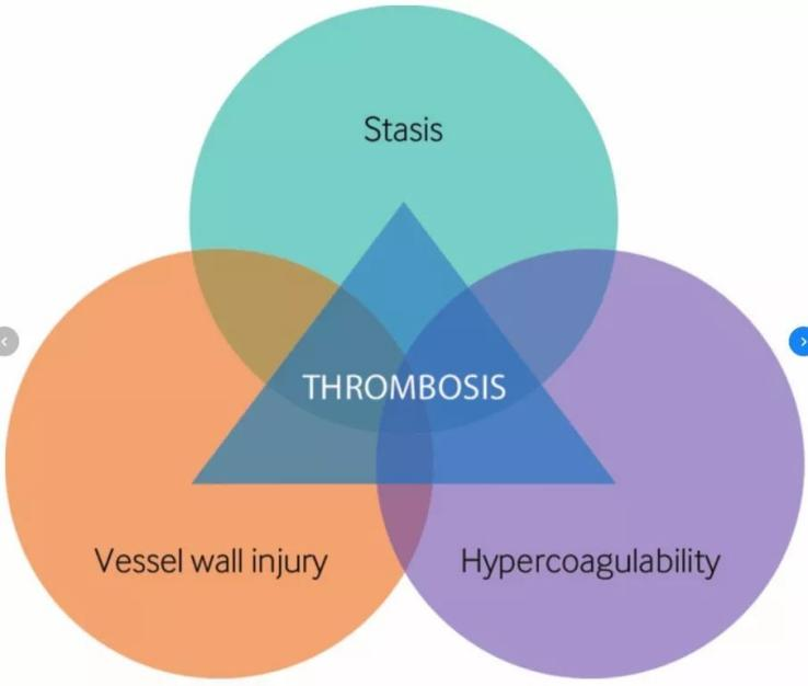 血栓形成，三個(gè)要素細(xì)分說(shuō)