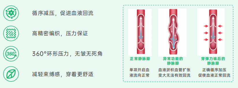 靜脈曲張該如何預(yù)防？